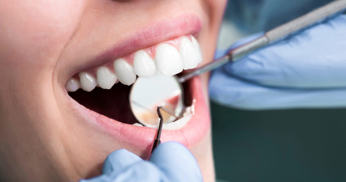 Dental professional examining a patient's teeth with a mirror and probe
